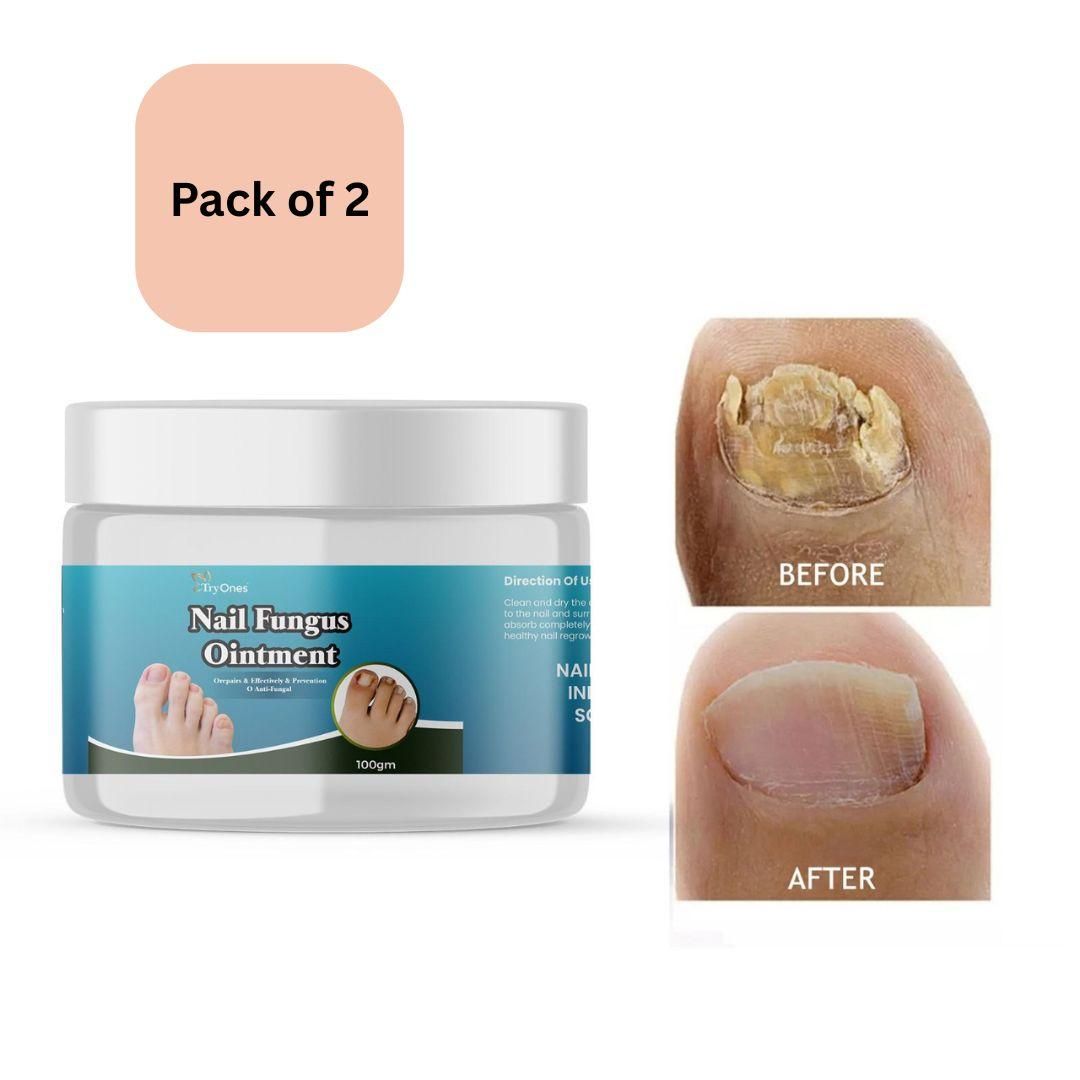 TryOnes Nail Fungus Ointment 100gram (Pack of 2)