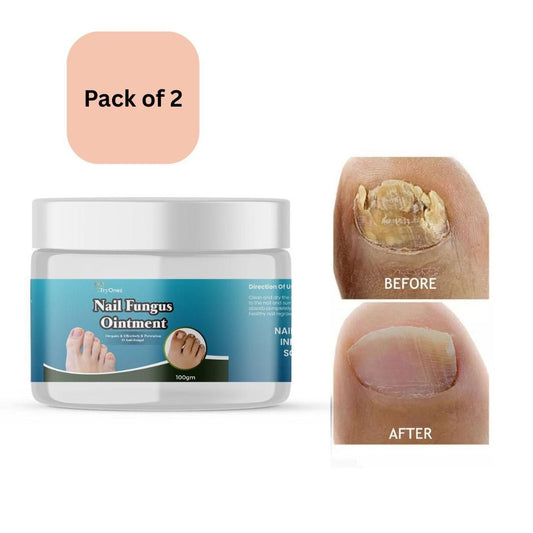TryOnes Nail Fungus Ointment 100gram (Pack of 2)